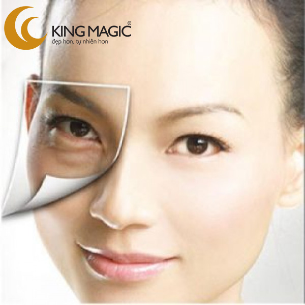 Phẫu thuật lấy da/mỡ mí dưới